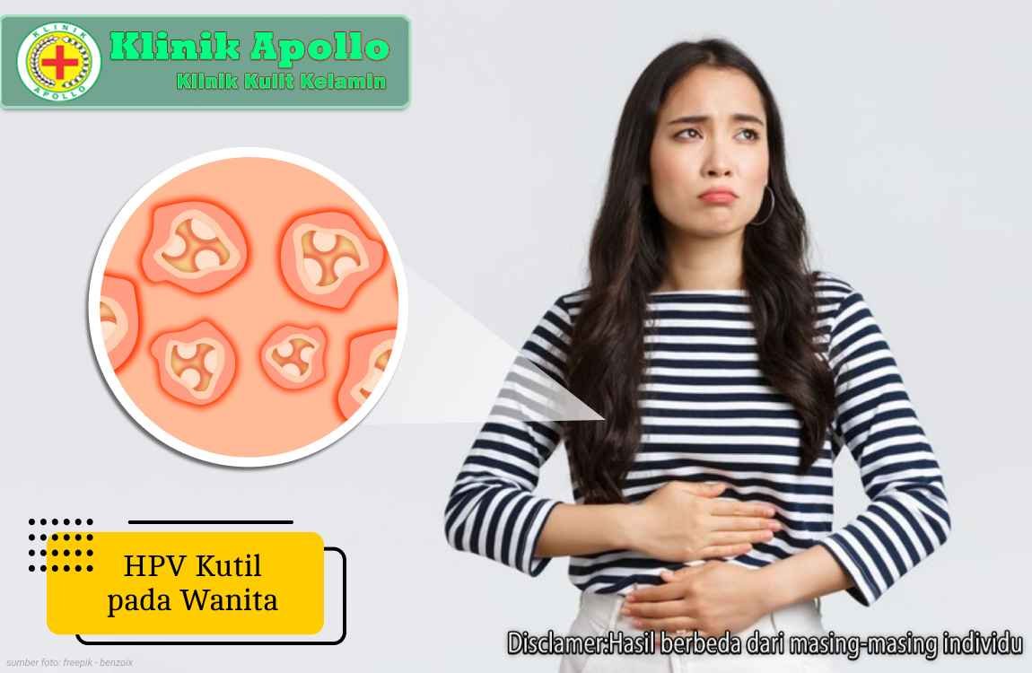 HPV Kutil pada Wanita