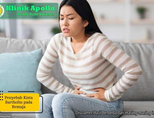 Intip! 5 Penyebab Kista Bartholin Wanita Berikut Penanganannya