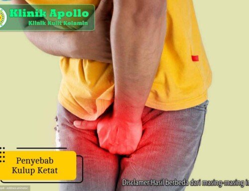 Ketahui, Penyebab Kulup Ketat pada Pria dan Cara Menanganinya