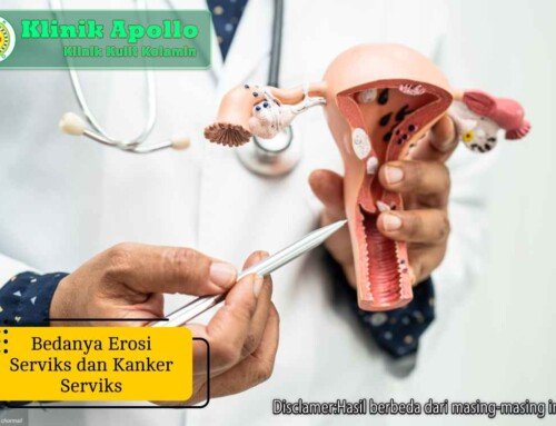 Kenali Bedanya Erosi Serviks dan Kanker Serviks pada Wanita