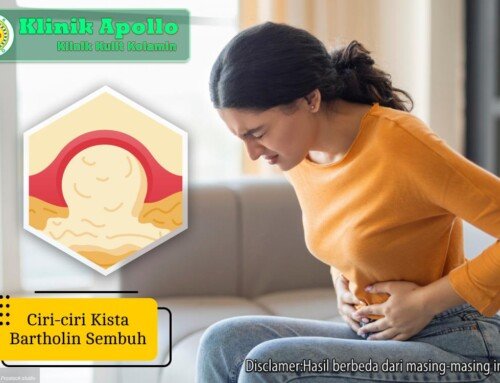 Waspada! 5 Ciri-ciri Kista Bartholin Sembuh Setelah Pengobatan