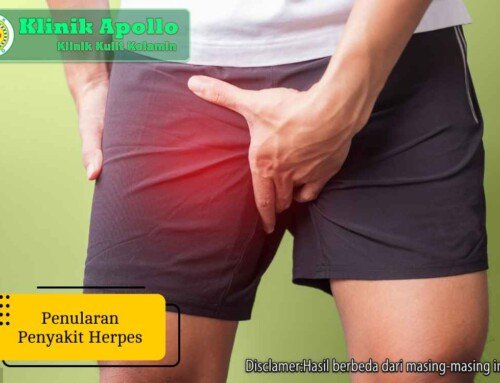 Waspada! 7 Ciri Penularan Penyakit Herpes yang Berbahaya