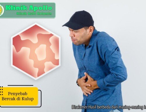 Kenali 7 Penyebab Bercak di Kulup Pria Berikut Pengobatannya