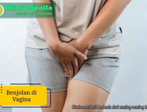 7 Penyebab Munculnya Benjolan di Vagina, Nomor 3 Berbahaya