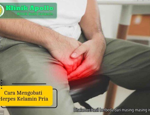 Ketahui 5 Cara Mengobati Herpes Kelamin Pria Secara Medis