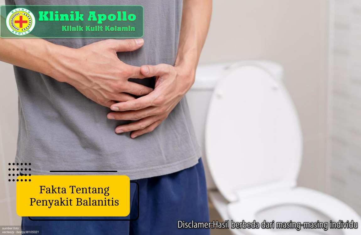 Ilustrasi Fakta Tentang Penyakit Balanitis.