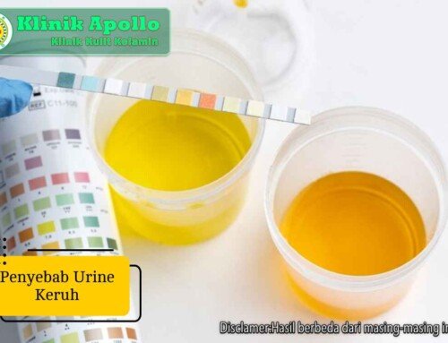 Cari Tahu Yuk! 5 Penyebab Urine Keruh dan Cara Mengobatinya