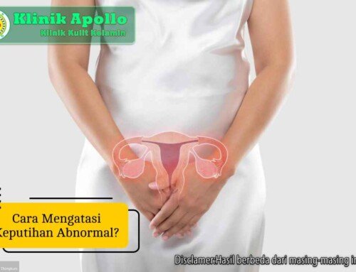 Simak! Cara Mengatasi Keputihan Abnormal pada Wanita