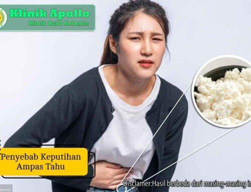 7 Penyebab Keputihan Ampas Tahu pada Remaja yang Parah