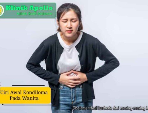 Ciri Awal Kondiloma pada Wanita: Benjolan Kecil Bisa Berbahaya!