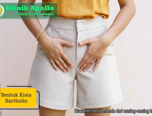 Jangan Keliru! Kenali Bentuk Kista Bartholin dan Cara Obatinya