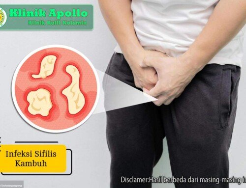Infeksi Sifilis Kambuh: Waspadai Ciri dan Langkah Penanganan