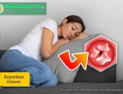 Waspada! Keputihan Gonore Jadi Tanda Infeksi Menular Seksual