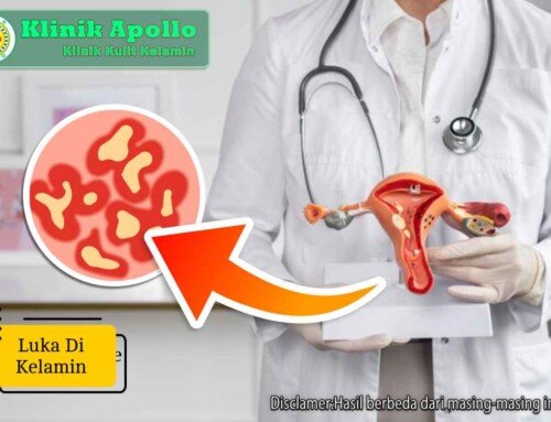 Jangan Diabaikan! Luka di Kelamin Jadi Tanda Penyakit Serius