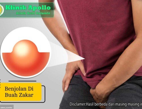 Sering Teraba Benjolan di Buah Zakar? Ini Sebab dan Solusinya
