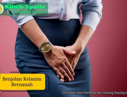 Kenali Penyebab Benjolan Kelamin Bernanah dan Cara Atasinya