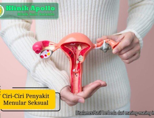 Ciri-ciri Penyakit Menular Seksual: Gejala, Penyebab, Pencegahan