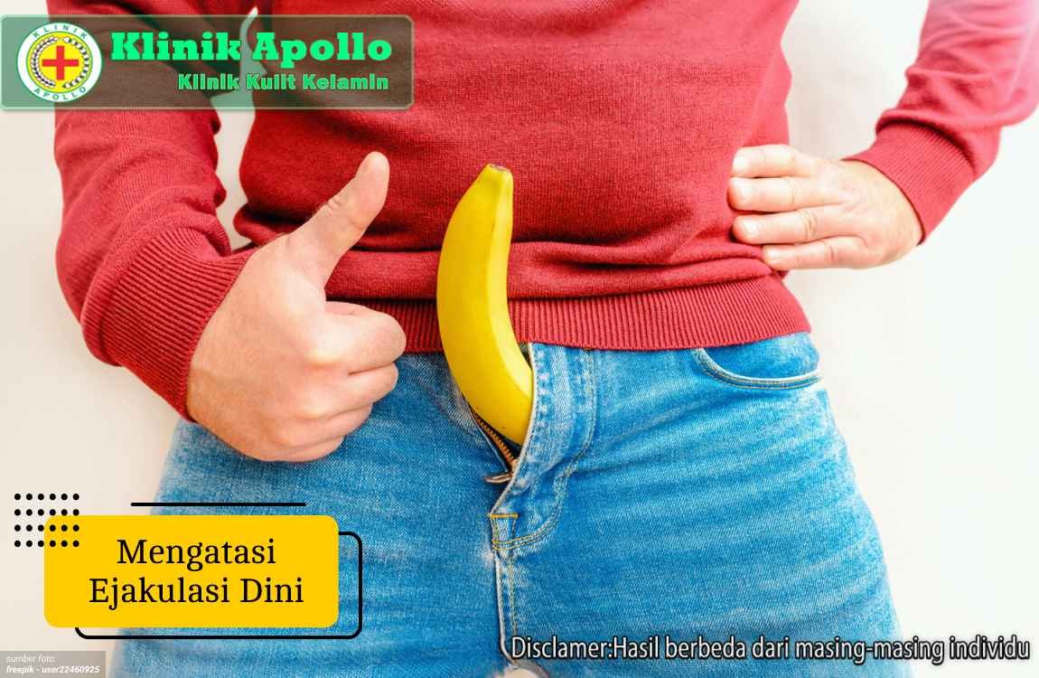 Ilustrasi Mengatasi Ejakulasi Dini.
