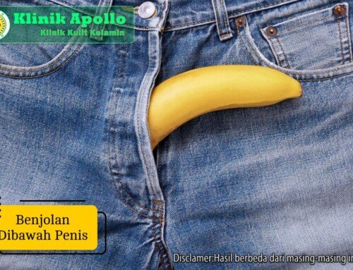 Penyebab Muncul Benjolan dibawah Penis dan Solusi Medisnya