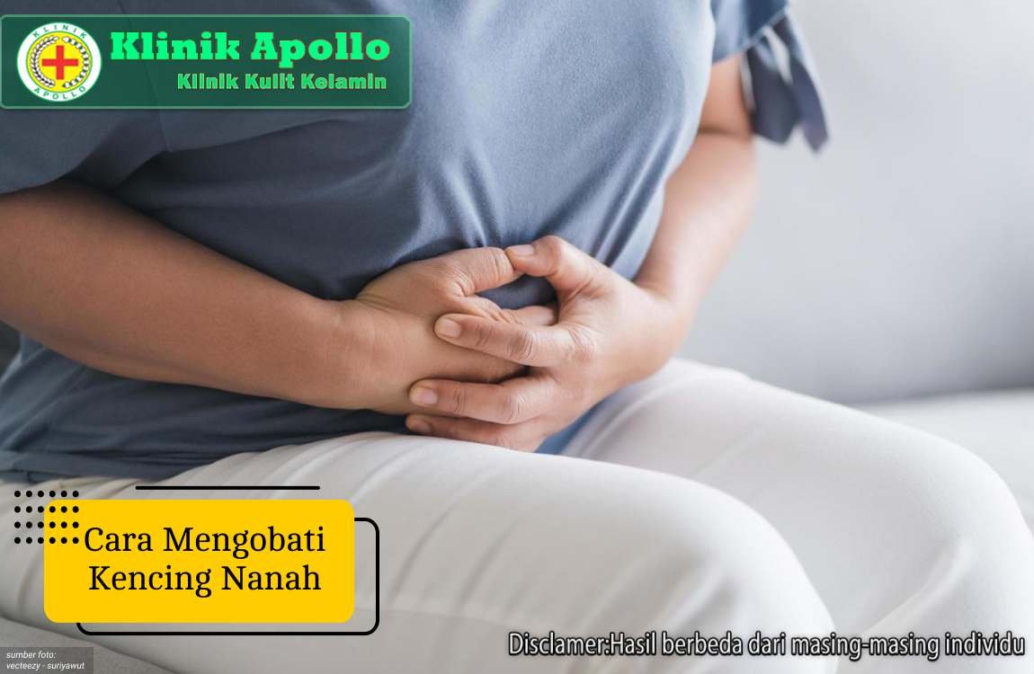 Ilustrasi Cara Mengobati Kencing Nanah.