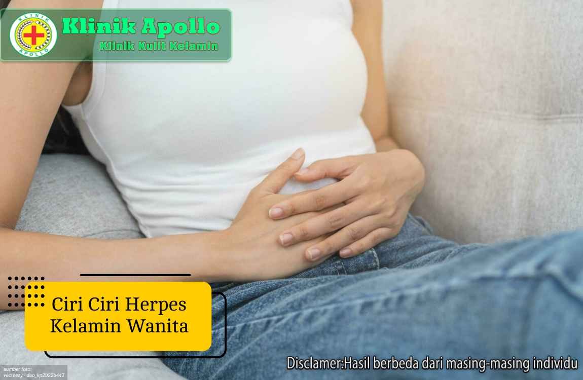 Ilustrasi Ciri ciri Herpes Kelamin Wanita.