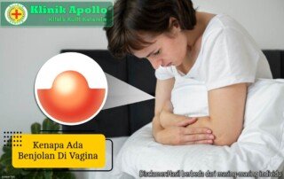 Ilustrasi Kenapa Ada Benjolan di Vagina.