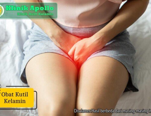 Obat Kutil Kelamin: Pilihan Medis dan Perawatan yang Tepat
