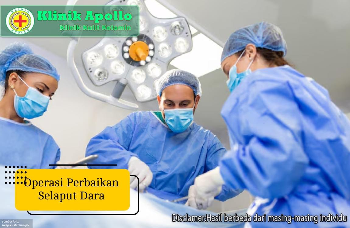 Ilustrasi Operasi Perbaikan Selaput Dara.