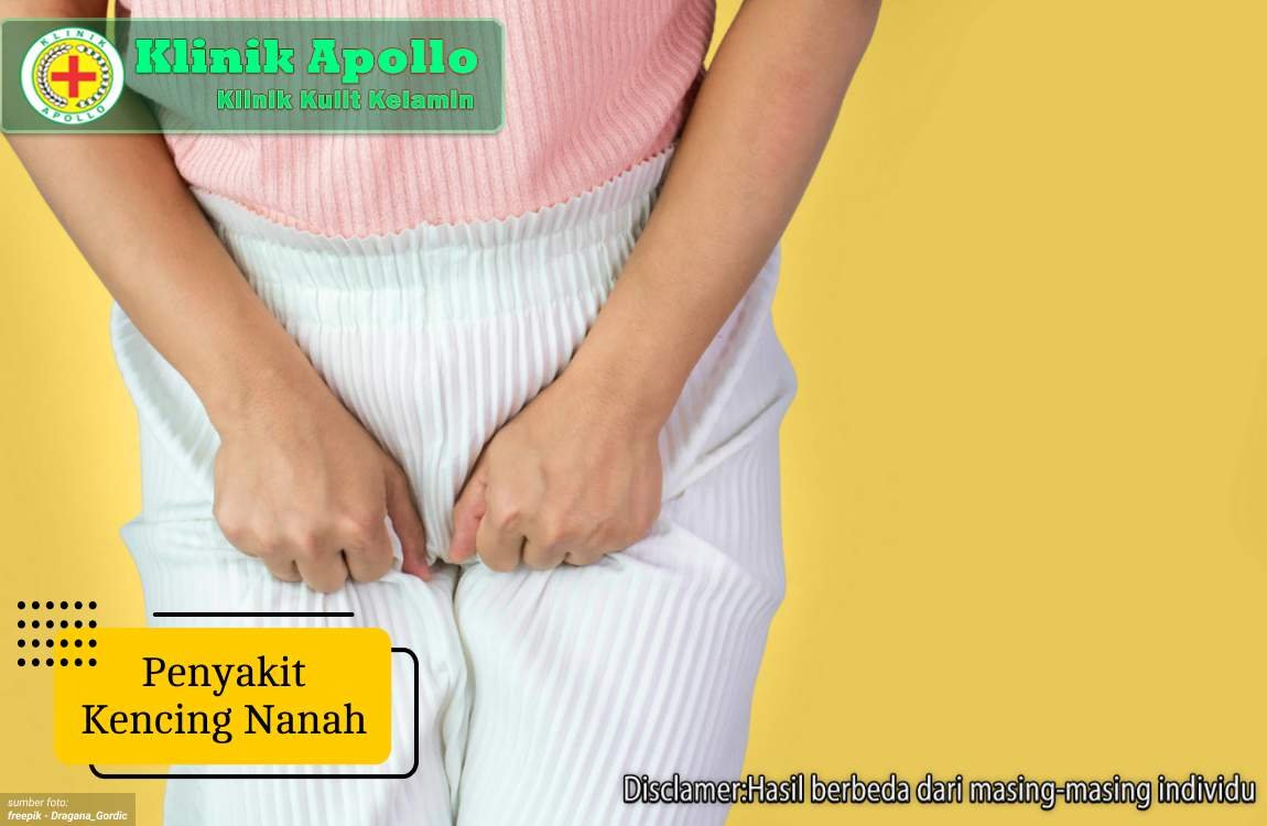 Ilustrasi Penyakit Kencing Nanah.