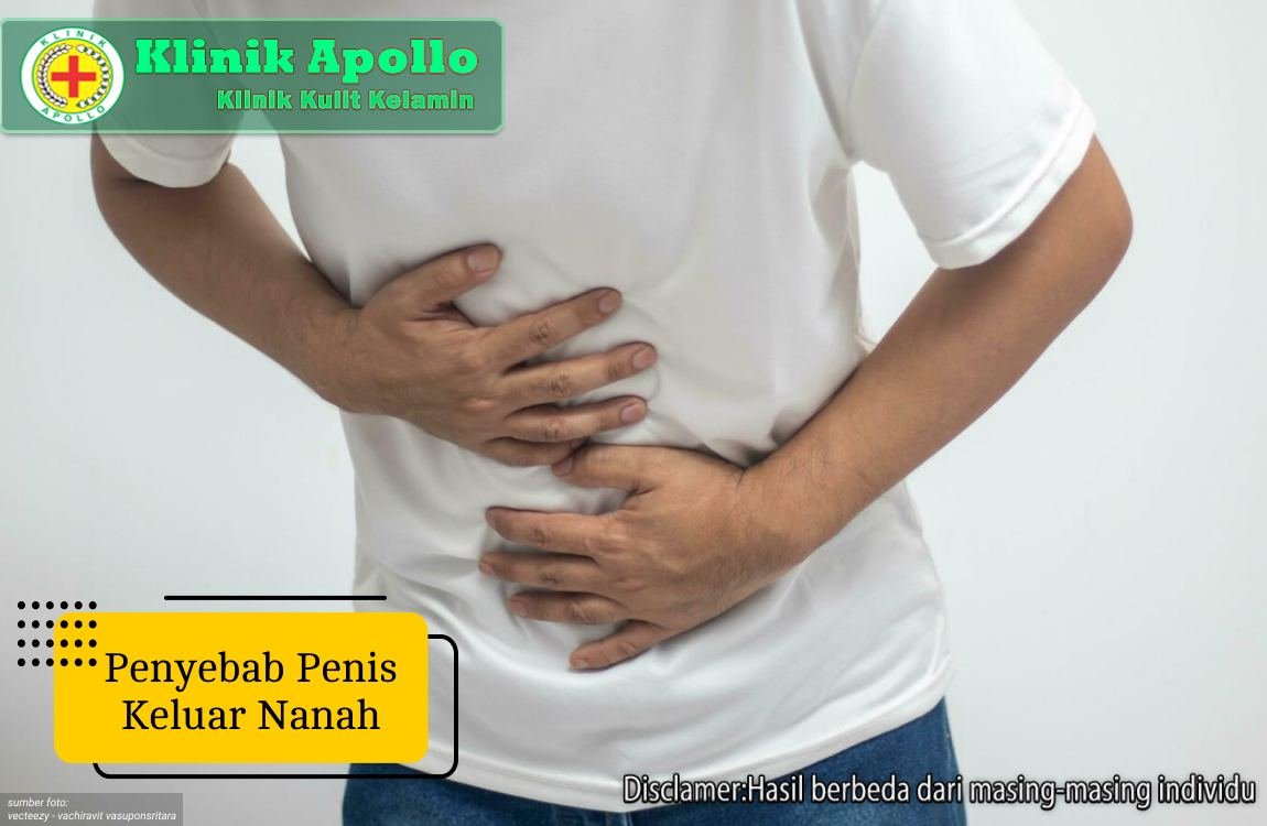 Ilustrasi Penyebab Penis Keluar Nanah.