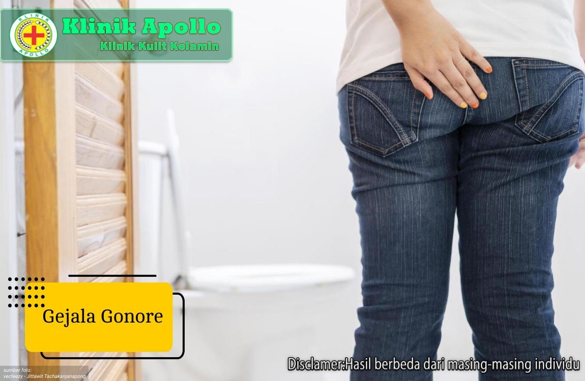 Ilustrasi Gejala Gonore.