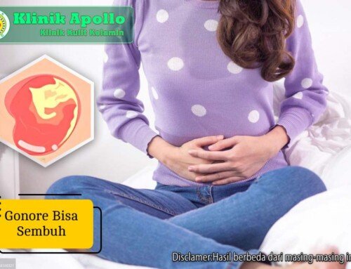 Gonore Bisa Sembuh dengan Pengobatan Tepat, Ini Penjelasannya