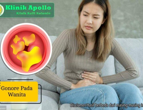 Gonore pada Wanita: Gejala, Dampak, dan Cara Mengobatinya