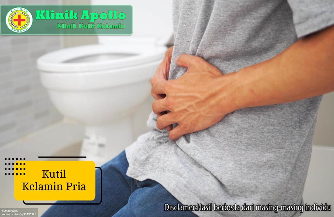 Ilustrasi Kutil Kelamin Pria.