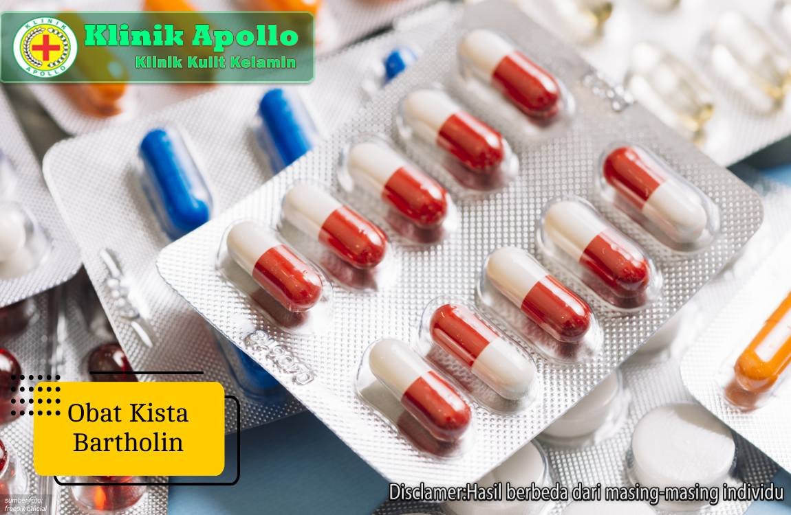 Ilustrasi Obat Kista Bartholin.