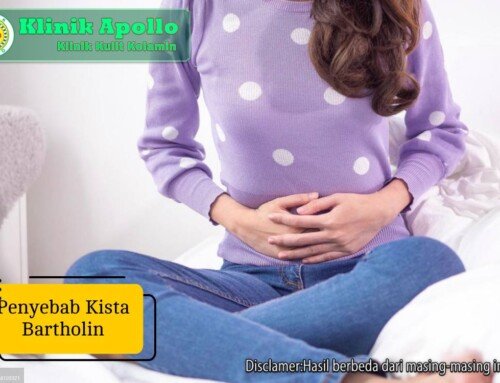 Penyebab Kista Bartholin dan Gejalanya: Kapan Harus ke Dokter?