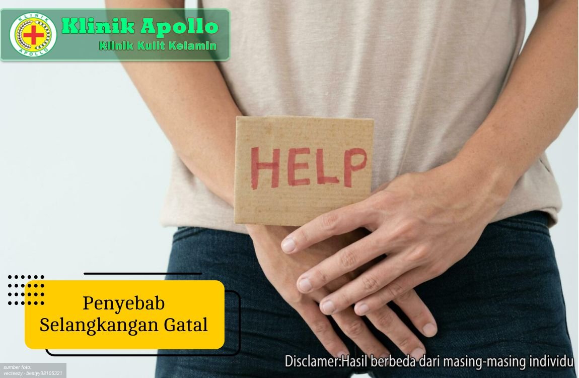 Ilustrasi Penyebab Selangkangan Gatal.