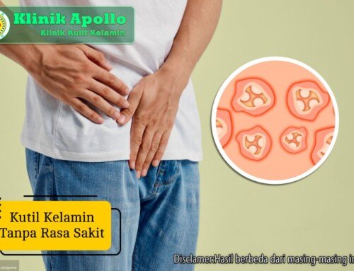 Kutil Kelamin Tanpa Rasa Sakit: Penyebab, Risiko & Penanganan