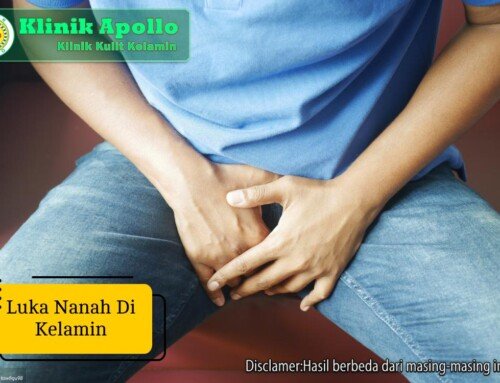 Bahaya Luka Nanah di Kelamin yang Dibiarkan Tanpa Pengobatan
