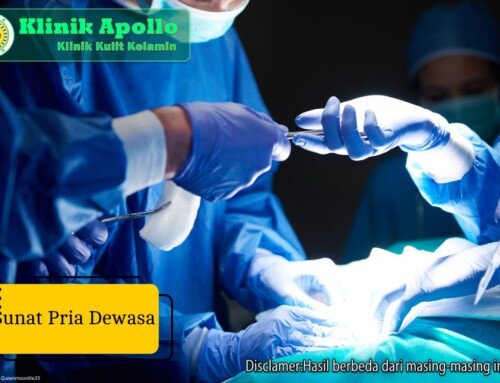 Sunat Pria Dewasa: Aman, Cepat, Minim Sakit & Teknologi Modern