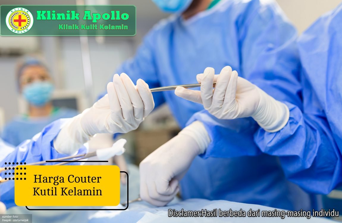 Ilustrasi Harga Couter Kutil Kelamin.