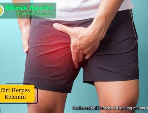 Ciri Herpes Kelamin dan Cara Mengatasinya dengan Tepat