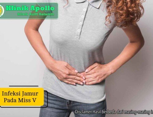 Infeksi Jamur pada Miss V & Risiko Komplikasi Salah Penanganan