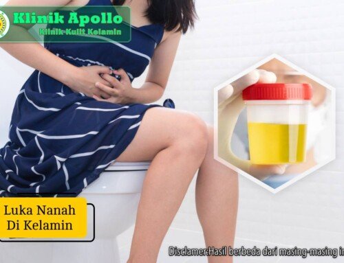 Luka Nanah di Kelamin Jangan Abaikan, Ini Risiko Jika Tak Diobati