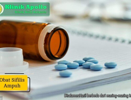 Obat Sifilis Ampuh untuk Mengatasi Infeksi Sejak Stadium Awal