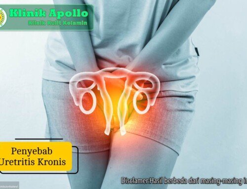 Waspada! Ini Penyebab Uretritis Kronis & Risiko Komplikasinya