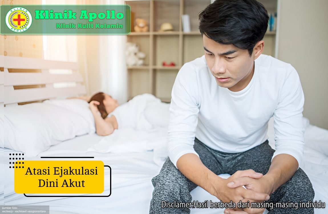 Ilustrasi Atasi Ejakulasi Dini Akut.