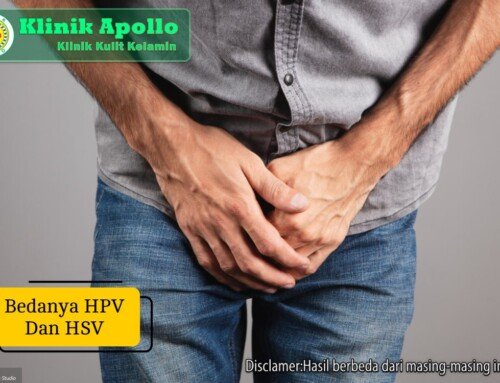 Bedanya HPV dan HSV dari Ciri, Penyebab, hingga Pengobatan