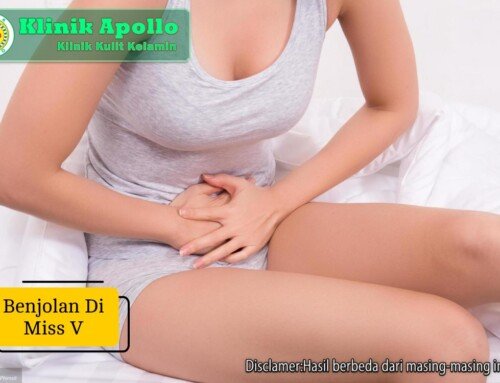 Benjolan di Miss V: Penyebab, Gejala, dan Cara Mengatasinya