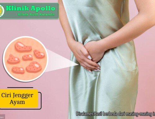 Waspada! Ini Ciri Jengger Ayam yang Bisa Menular ke Pasangan